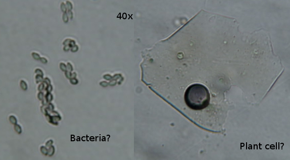 Goat poop under a microcscope